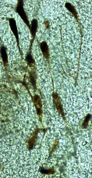 Photo 8 - gloeocystis pédicellées1 x400-redim1024