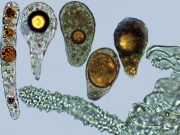 Photo 9 - gloeocystis non pédicellées1 x1000-redim1024